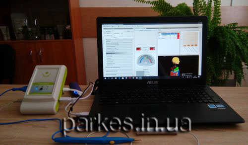 Діагностичний комплекс Паркес. Діагностика Паркес. Паркес Д Діагностичний комплекс Паркес. Діагностика Паркес. Паркес Д